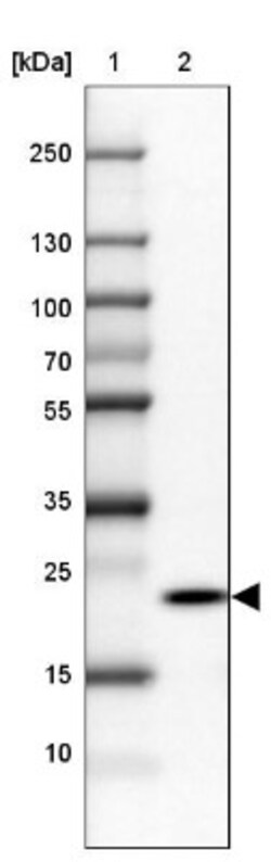 RPP25 Antibody, Novus Biologicals 25 &mu;L, Unconjugated:Antibodies, Polyclonal