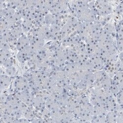 RPP30 Antibody, Novus Biologicals:Antibodies:Primary Antibodies
