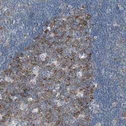 RPS12 Antibody, Novus Biologicals 0.1mL; Unlabeled:Antibodies, Polyclonal