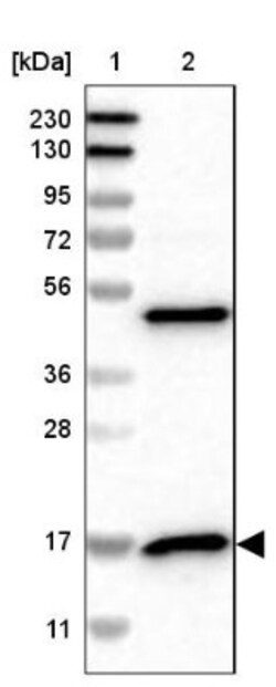 RPS14 Antibody, Novus Biologicals:Antibodies:Primary Antibodies