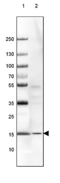 RPS14 Antibody, Novus Biologicals:Antibodies:Primary Antibodies