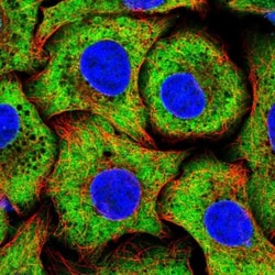 RPS15 Antibody, Novus Biologicals 0.1mL; Unlabeled:Antibodies, Polyclonal
