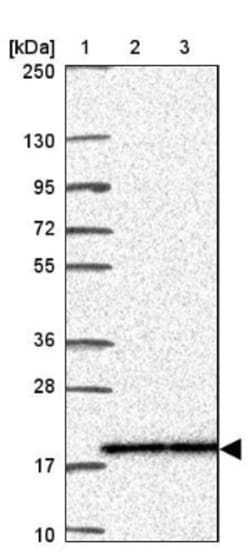RPS15 Antibody, Novus Biologicals 0.1mL; Unlabeled:Antibodies, Polyclonal