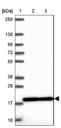 RPS15 Antibody, Novus Biologicals 0.1mL; Unlabeled:Antibodies, Polyclonal