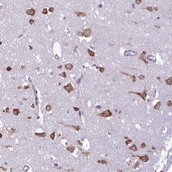 RPS16 Antibody, Novus Biologicals:Antibodies:Primary Antibodies
