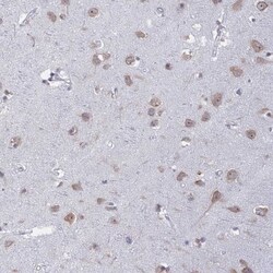 RPS19BP1 Antibody, Novus Biologicals 0.1mL; Unlabeled:Antibodies, Polyclonal