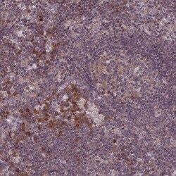 RPS19BP1 Antibody, Novus Biologicals 0.1mL; Unlabeled:Antibodies, Polyclonal