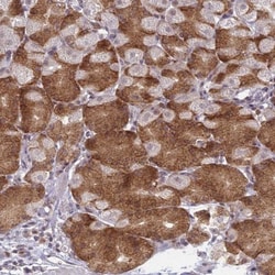 RPS19BP1 Antibody, Novus Biologicals 0.1mL; Unlabeled:Antibodies, Polyclonal