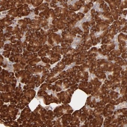 RPS20 Antibody, Novus Biologicals 0.1mL; Unlabeled:Antibodies, Polyclonal