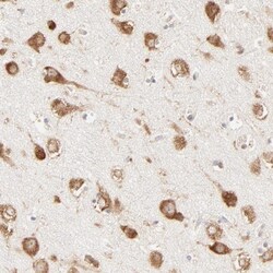 RPS20 Antibody, Novus Biologicals 0.1mL; Unlabeled:Antibodies, Polyclonal