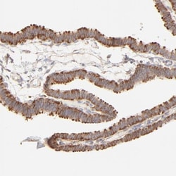 RPS20 Antibody, Novus Biologicals 0.1mL; Unlabeled:Antibodies, Polyclonal