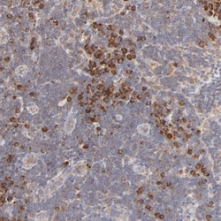 RPS20 Antibody, Novus Biologicals 0.1mL; Unlabeled:Antibodies, Polyclonal