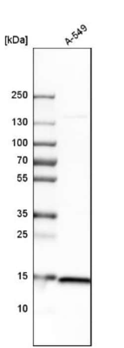 RPS20 Antibody, Novus Biologicals 0.1mL; Unlabeled:Antibodies, Polyclonal