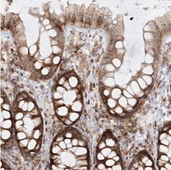 RPS25 Antibody, Novus Biologicals 25ul | Buy Online | Novus Biologicals | Fisher Scientific