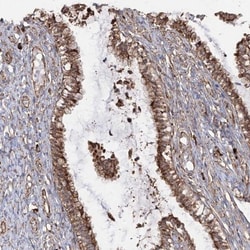RPS25 Antibody, Novus Biologicals 25ul | Buy Online | Novus Biologicals | Fisher Scientific