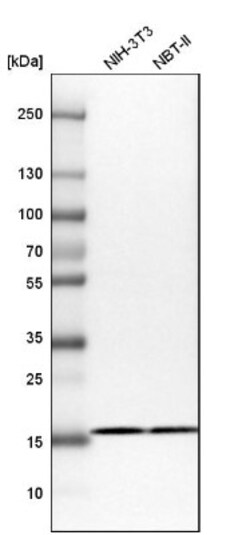 RPS25 Antibody, Novus Biologicals 25ul | Buy Online | Novus Biologicals | Fisher Scientific