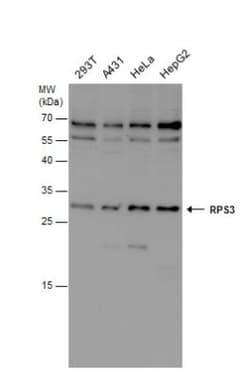 RPS3 Antibody, Novus Biologicals 0.1mg; Unlabeled:Antibodies, Polyclonal
