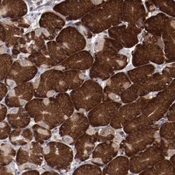 RPS4X Antibody, Novus Biologicals 25 &mu;L; Unlabeled:Antibodies, Polyclonal