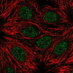 RPS6KL1 Antibody, Novus Biologicals 25 &mu;L; Unlabeled:Antibodies, Polyclonal