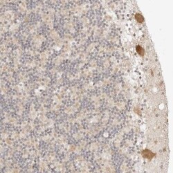 RPS6KL1 Antibody, Novus Biologicals 25 &mu;L; Unlabeled:Antibodies, Polyclonal