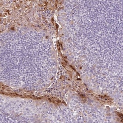 RPTN Antibody, Novus Biologicals 25 &mu;L, Unlabeled:Antibodies, Polyclonal