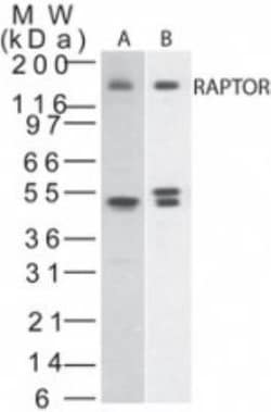 RPTOR Antibody, Novus Biologicals 0.2mL; Unlabeled:Antibodies, Polyclonal