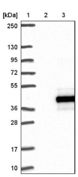 RPUSD1 Antibody, Novus Biologicals:Antibodies:Primary Antibodies