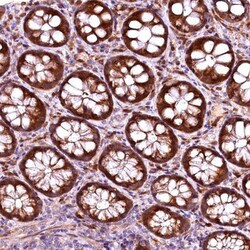 RPUSD2 Antibody, Novus Biologicals:Antibodies:Primary Antibodies