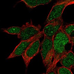 RPUSD3 Antibody, Novus Biologicals:Antibodies:Primary Antibodies