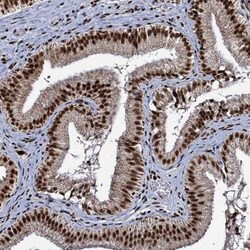 RPUSD4 Antibody, Novus Biologicals 0.1mL; Unlabeled:Antibodies, Polyclonal
