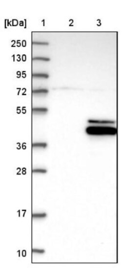 RPUSD4 Antibody, Novus Biologicals 0.1mL; Unlabeled:Antibodies, Polyclonal