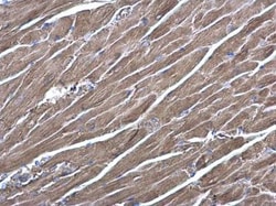 RRAS Antibody, Novus Biologicals 0.1mL; Unlabeled:Antibodies, Polyclonal