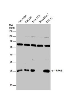 RRAS Antibody, Novus Biologicals 0.1mL; Unlabeled:Antibodies, Polyclonal