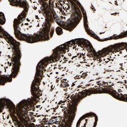 RRBP1 Antibody, Novus Biologicals 25 &mu;L; Unlabeled:Antibodies, Polyclonal