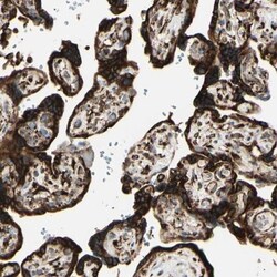 RRBP1 Antibody, Novus Biologicals 25 &mu;L; Unlabeled:Antibodies, Polyclonal