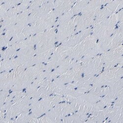 RRBP1 Antibody, Novus Biologicals 0.1mL; Unlabeled:Antibodies, Polyclonal