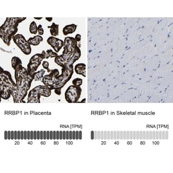 RRBP1 Antibody, Novus Biologicals 0.1mL; Unlabeled:Antibodies, Polyclonal