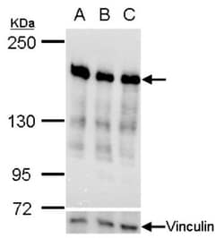 RRBP1 Antibody, Novus Biologicals 0.1mg; Unlabeled:Antibodies, Polyclonal