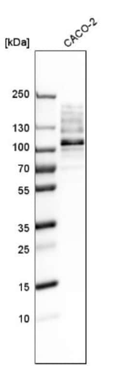 RRBP1 Antibody, Novus Biologicals 25 &mu;L; Unlabeled:Antibodies, Polyclonal