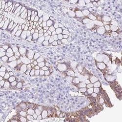 RRM2 Antibody, Novus Biologicals 25 &mu;L; Unlabeled:Antibodies, Polyclonal