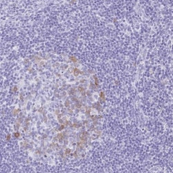 RRM2 Antibody, Novus Biologicals 25 &mu;L; Unlabeled:Antibodies, Polyclonal
