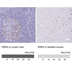 RRM2 Antibody, Novus Biologicals 25 &mu;L; Unlabeled:Antibodies, Polyclonal