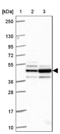 RRM2 Antibody, Novus Biologicals 25 &mu;L; Unlabeled:Antibodies, Polyclonal
