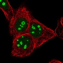 RRN3 Antibody, Novus Biologicals 0.1mL; Unlabeled:Antibodies, Polyclonal
