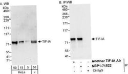 RRN3 Antibody, Novus Biologicals 0.1mg; Unlabeled:Antibodies, Polyclonal