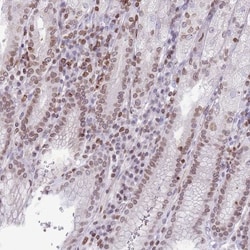 RRNAD1 Antibody, Novus Biologicals:Antibodies:Primary Antibodies