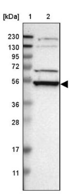 RRP1 Antibody, Novus Biologicals 0.1mL; Unlabeled:Antibodies, Polyclonal