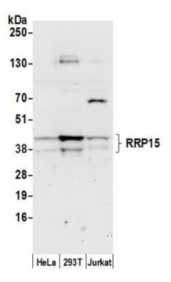 RRP15 Antibody, Novus Biologicals 100&mu;L; Unlabeled:Antibodies, Polyclonal