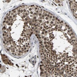 RRP1B Antibody, Novus Biologicals 0.1mL; Unlabeled:Antibodies, Polyclonal