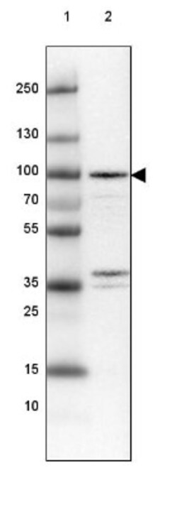 RRP1B Antibody, Novus Biologicals 0.1mL; Unlabeled:Antibodies, Polyclonal